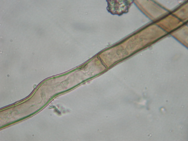 Geopora sumneriana ... in MICRO